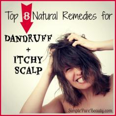 Dry Scalp Home Remedies, Natural Treatments & Cure