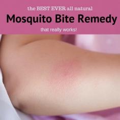
                    
                        Mosquitoes may be tiny but they sure can be a big problem with those itchy bites! This remedy just might just save you from long nights lying awake scratching  #mosquitobite #ad #ebay #stopscratching
                    
                