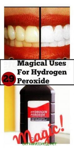 29 Magical DIY Uses For Hydrogen Peroxide - ExtraWellness