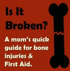 Broken Bones Guide