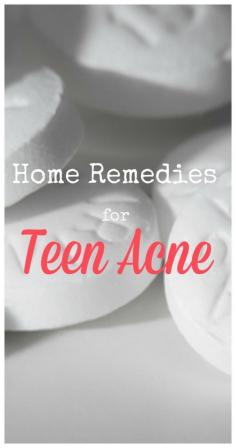 Adult too? Home Remedies for Teen Acne - Simple solutions for clear skin.