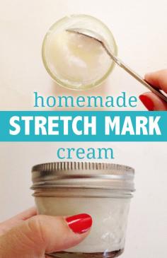 
                    
                        DIY Homemade Stretch Mark Cream
                    
                
