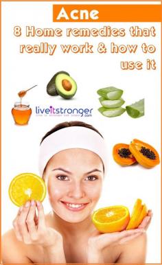 
                    
                        Home remedies for #acne . #papaya, #avocado , #honey , Orange are there in the list. Learn how to use it to treat your #pimples and Acne
                    
                