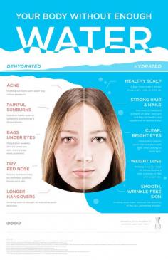 37. This is Your Body without #Water - 38 Helpful #Beauty #Infographics to Pore over ... → Beauty [ more at http://beauty.allwomenstalk.com ]  #Personal #Care #Healthier #Skin #Hair