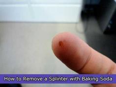 
                    
                        How to Remove a Splinter with Baking Soda
                    
                