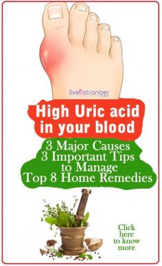 
                    
                        Hoe to reduce high #uric acid in your body naturally. #hyperuricemia causes #gout a painful arthritis. Foods to avoid in gout anf home remedies for #highuricacid.
                    
                