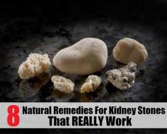 
                    
                        8 Natural Remedies for Kidney Stones That Really Work
                    
                